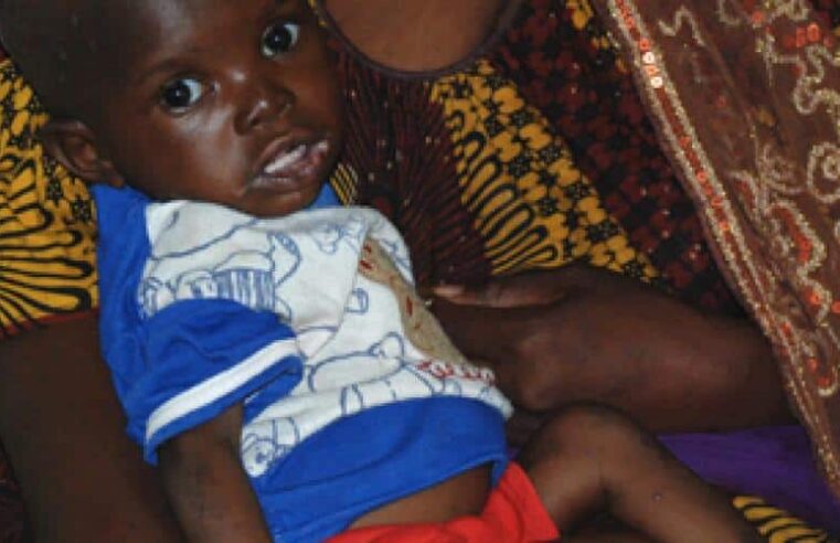 Malnutrition au Mali : enjeux et solutions pour les populations