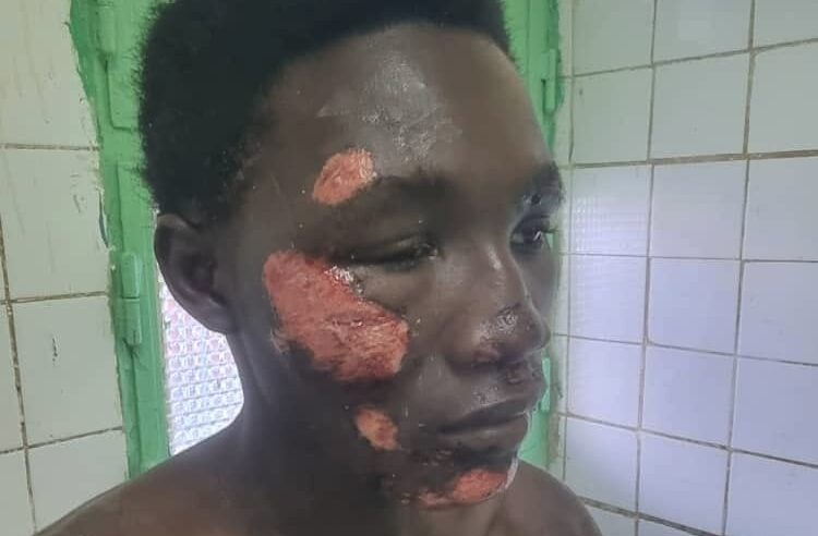 Tchad : un père interpelle les autorités après l&rsquo;agression près du camp 27